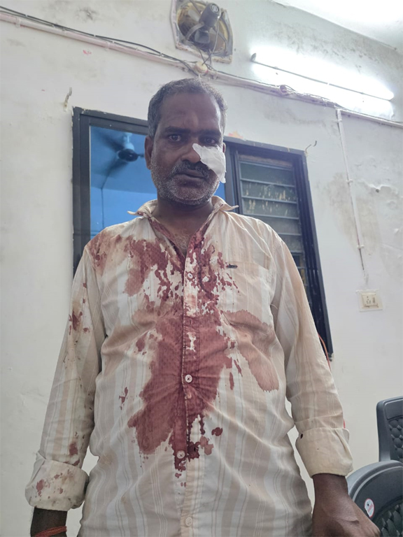 ब्रेकिंग: सांकरा थाना क्षेत्र में सीमांकन के दौरान बवाल- पुलिस और प्रशासन की मौजूदगी में चली लाठी, पटवारी-आरआई पर भी मारपीट का आरोप!! Web Morcha हेमंत पटेल को आई चोट पुलिस जांच में जुटी