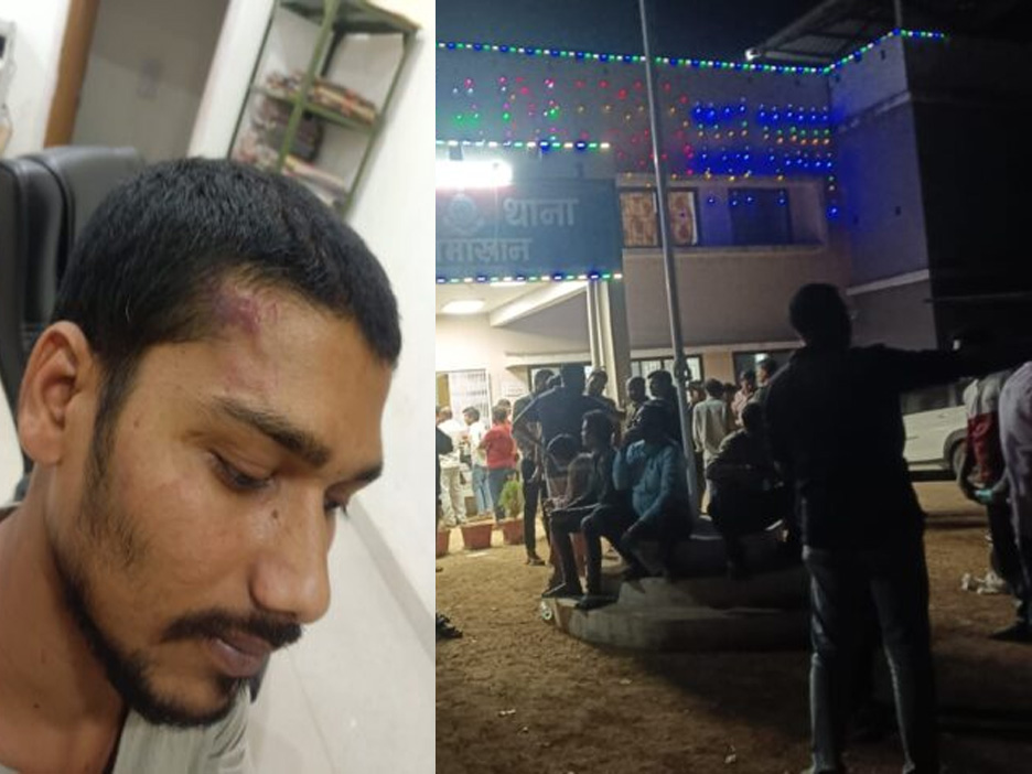 ₹50 के चिकन चिली के विवाद में व्यापारी पर जानलेवा हमला, कोमाखान में हड़कंप