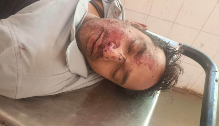 बागबाहरा हवलदार दयासागर की सड़क हादसे में मौत, साकरा के पास ट्रक की चपेट में आए