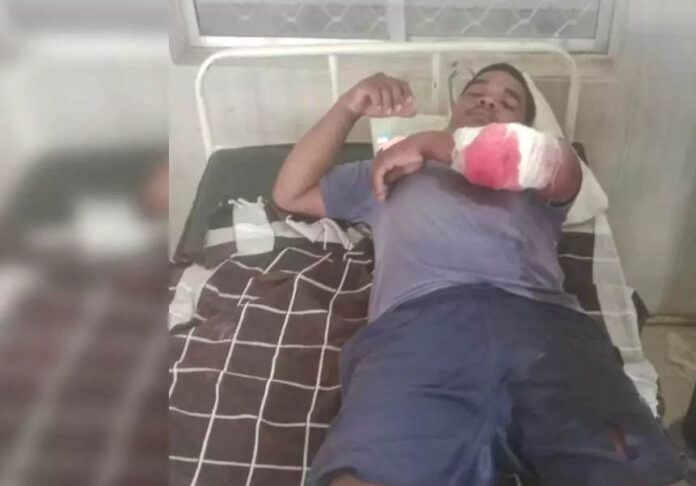भालुओं का हमला: जंगल में फुटू बीनने गए तीन ग्रामीण घायल, दो की हालत गंभीर
